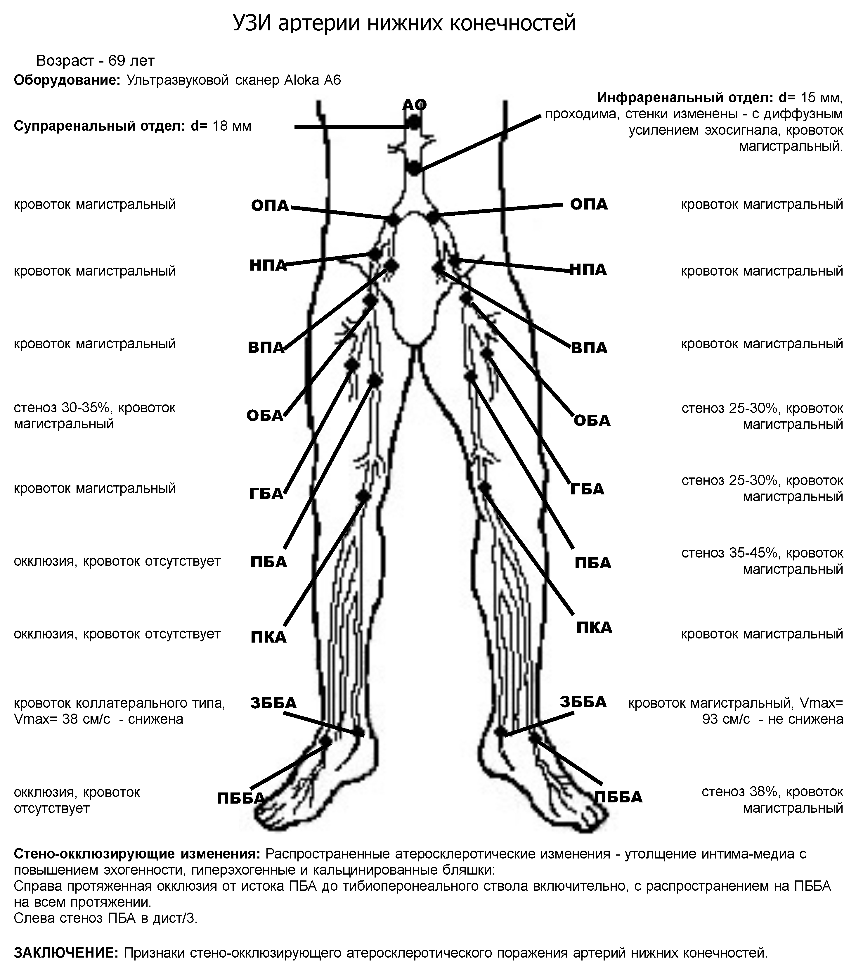 Протокол ультразвукового исследования артерий нижних конечностей